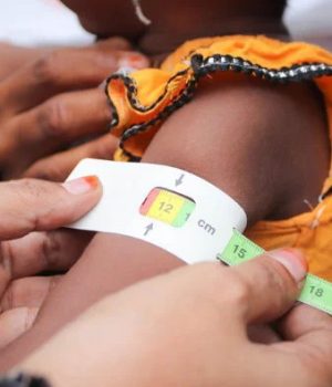 बाल कुपोषण न्यूनीकरणका लागि कानुन, बजेट र जनचेतनामा जोड